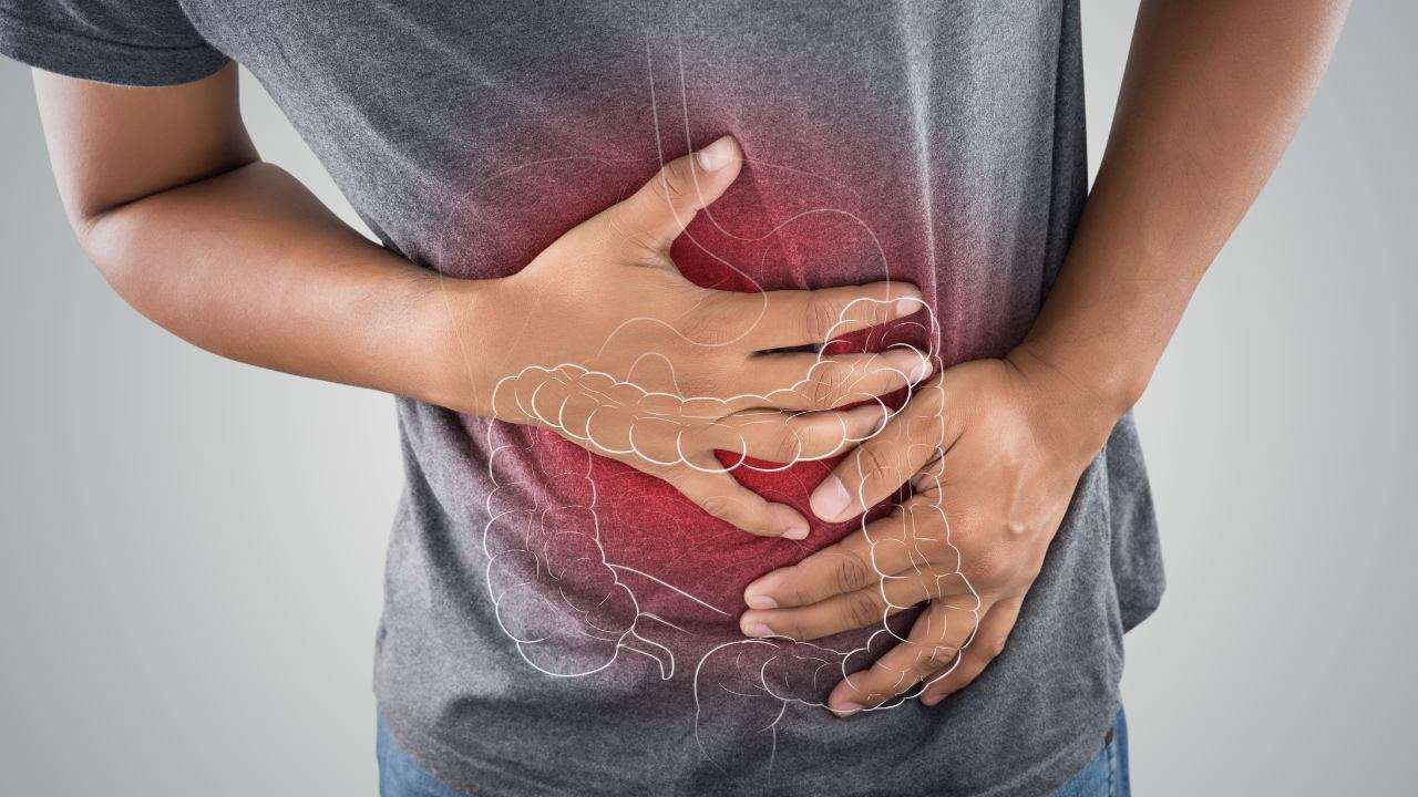 megacolon tossico